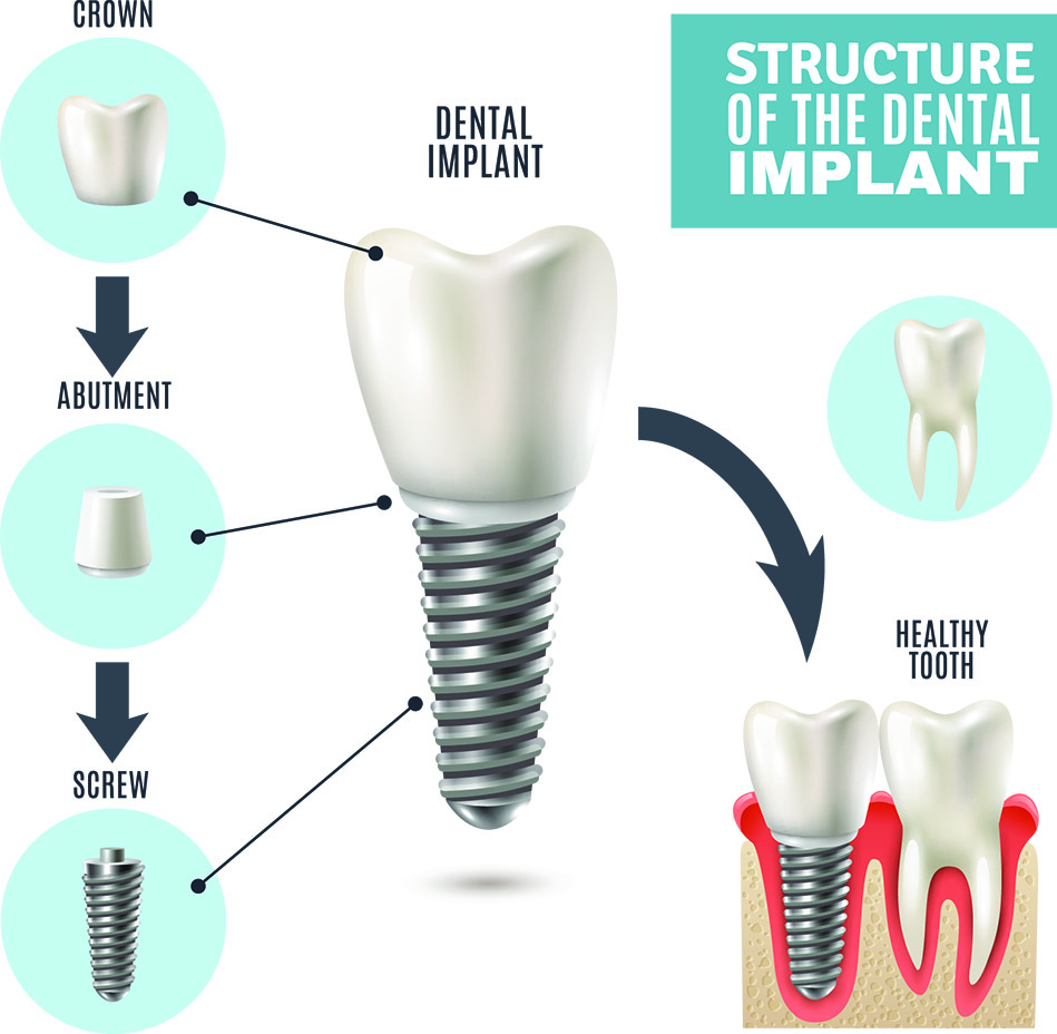 Implantology